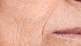 Rides du bas du visage